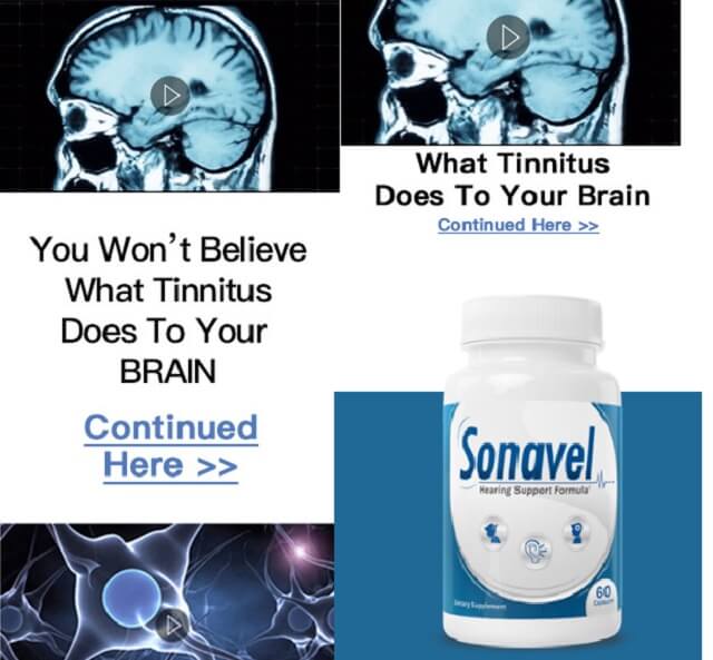 Sonavel Review 2022: Ingredient, Benefits & Side effects